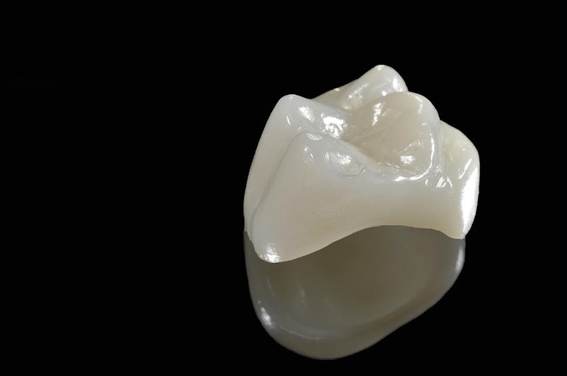 Porcelain Crowns in Livingston and Kearny