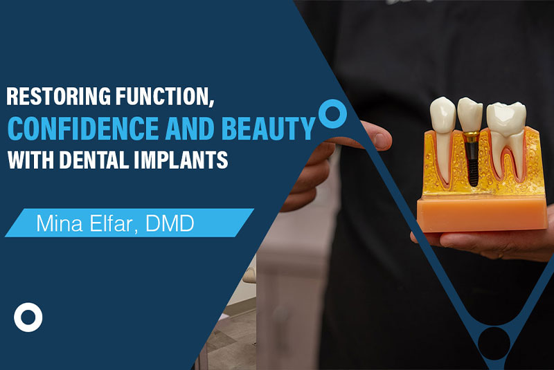 Restoring Function, Confidence And Beauty With Dental Implants