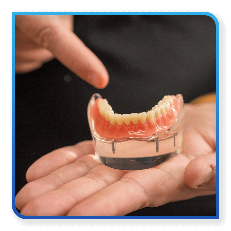 implant model