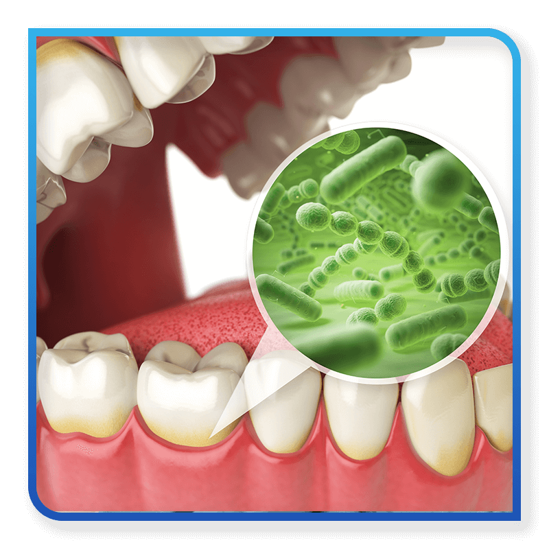 infection on tooth