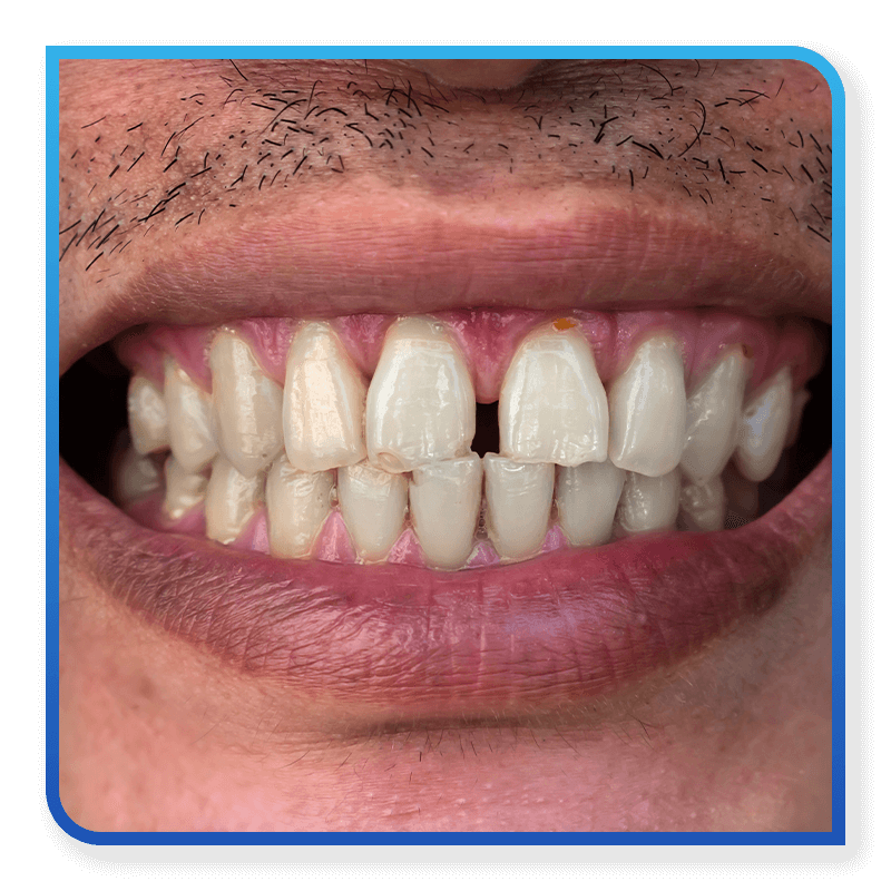 man smiling