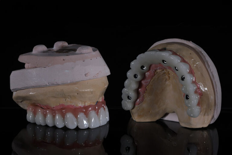 2 full arches of teeth being shown with them connected to jaw models