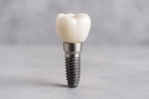 a crown on top of a dental implant
