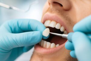 Close up of a dentist placing a porcelain veneer on a patient's tooth, with dental tools and bright lighting in the background. No text on image.