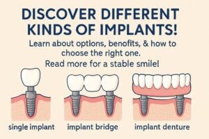 Image showcasing the different kinds of implants including endosteal, subperiosteal, zygomatic, mini dental implants, and All-on-4 implants. No text on the image.